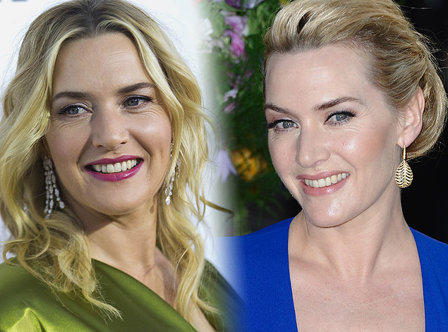 Газеты утверждают, что преображение не обошлось без "уколов красоты"! GLOBAL LOOK PRESS