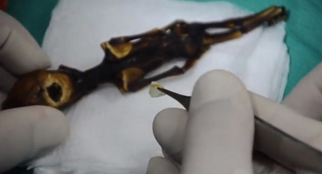 Из мумии извлекли мозг - вроде бы он там был