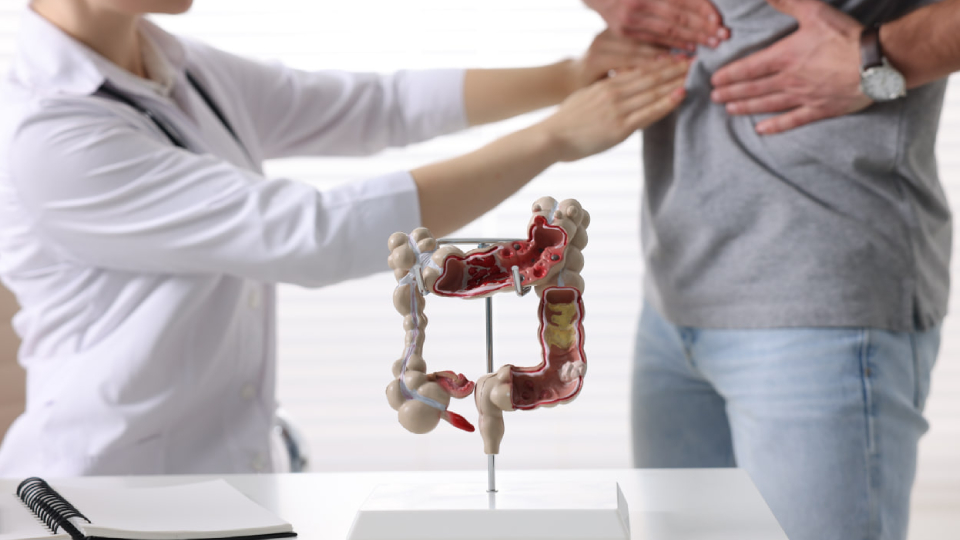 Полипы в кишечнике у взрослых: причины, симптомы, лечение, профилактика ...