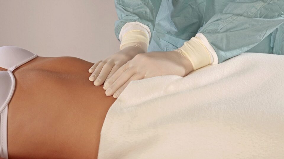 Грыжа белой линии живота у взрослых