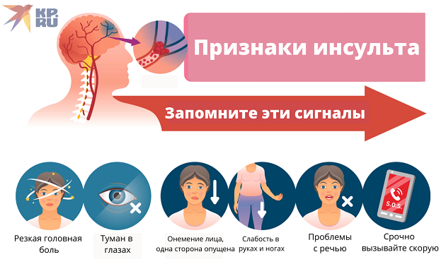 Признаки инсульта