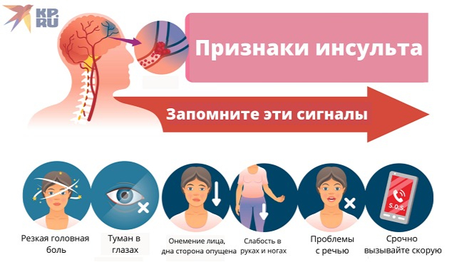 Признаки инсульта