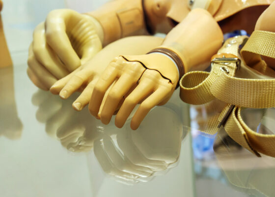 Протезы рук
