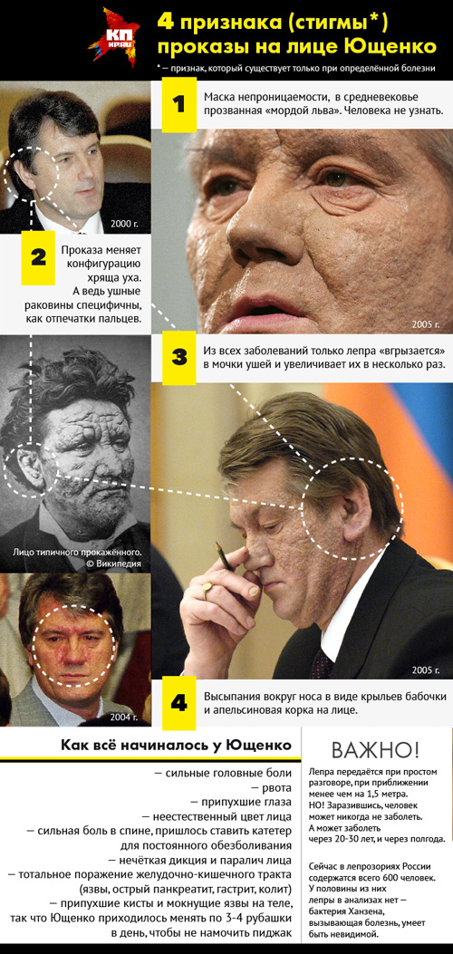 Как живут прокажённые в Непале - ЯПлакалъ